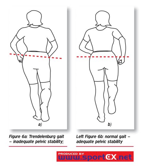 trendelenburg vs hip drop test|trendelenburg hip test pdf.